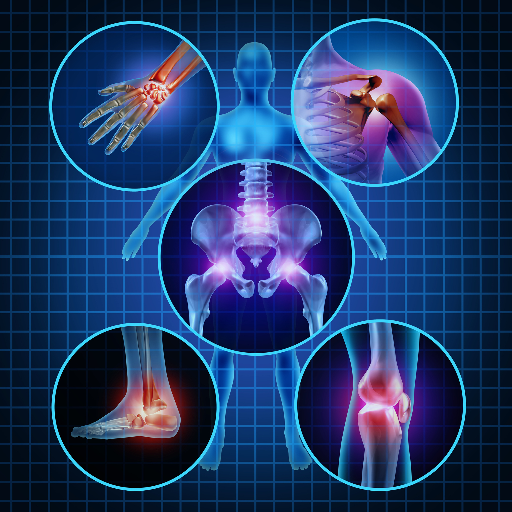 Painful joints human anatomy concept with the body as a group of circular panels of sore areas as a pain and injury or arthritis illness symbol for health care and medical symptoms due to aging or sports and work injury.